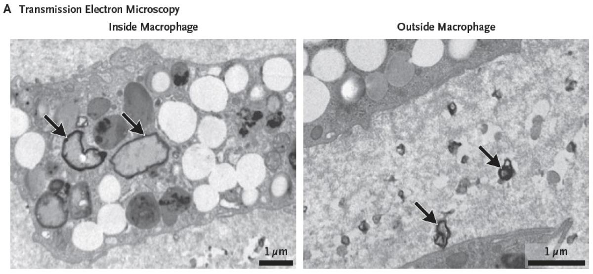 PlasticsInPlaquesUnderMicroscope.jpeg